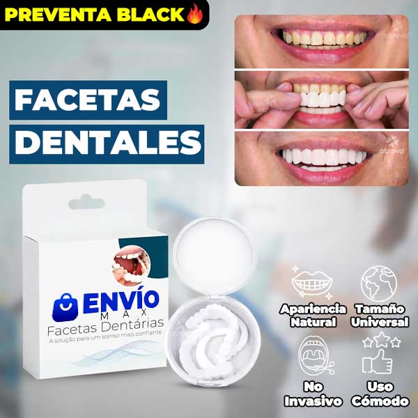 SonrisaPerfecta® - Carillas Dentales Naturales Removibles
